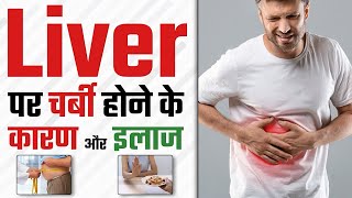 Fatty liverliver me sujanliver me charbi ki Homoeopathic medicine  liver fattyliver fatloss [upl. by Damalus]