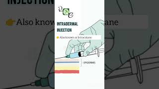 INTRADERMAL INJECTION pharmacy nursing neet science biology [upl. by Ttayh]