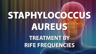 Staphylococcus Aureus  RIFE Frequencies Treatment  Energy amp Quantum Medicine with Bioresonance [upl. by Janeta]