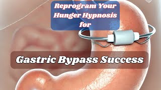 Reprogram Your Hunger Hypnosis for Gastric Bypass Success [upl. by Yesteb]