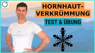 HORNHAUTVERKRÜMMUNG Wegtrainieren  Test Übung amp Training [upl. by Thgiwed]