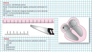 Flutter AURICULAR  Clases EKG 42 [upl. by Caldwell]