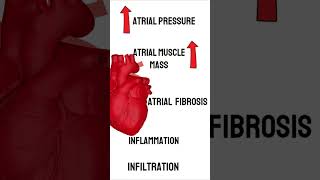 What causes Atrial Fibrillation medicine cardiology medical [upl. by Lenaj]