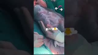 child born videobaby inside belly futuredoctor1257 [upl. by Ahsatsana112]