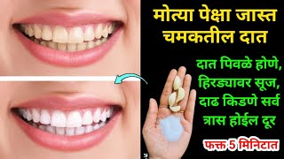 घरातील फक्त 2 वस्तू वापरा दातांन संबंधित सर्व समस्या दूर होतील😱 kitchen tips  home remedies  tadka [upl. by Shirberg871]