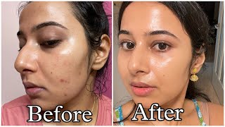 Simple Tretinoin Night Skincare Routine for Acne free Glowing Skin skincare skincareroutine [upl. by Llewej548]