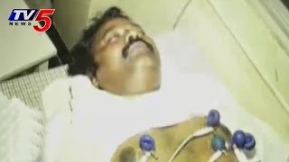 Congress Candidate Gajuwaka Sudhakar Naidu Attacked By Some Miscreants [upl. by Dnalyag]