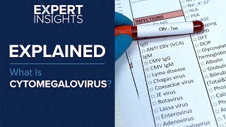 Expert Insights What is cytomegalovirus CMV [upl. by Longfellow25]