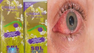 EUPHRASIA EYE DROPS  यूफ्रेसिया आंख का ड्रॉप हिंदी में  EUPHRASIA EYE DROPS IN HINDI [upl. by Yves]