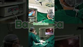 Cirurgia Bariátrica bypass ou Sleeve [upl. by Moseley]