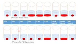 Reaction of inhibition of hemagglutination for detection the antibidies in pair sera [upl. by Hairahs]