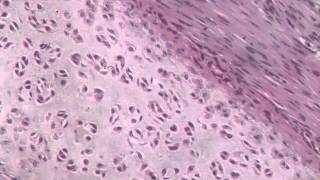 Hyaline Cartilage Trachea [upl. by Iramat]