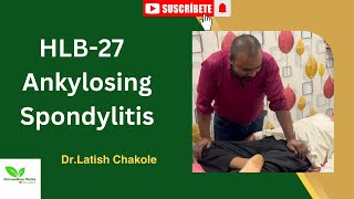 HLB27 Ankylosis Spondylitis  Treatment By Girivardhan Herbs Bone Setting [upl. by Perlie]