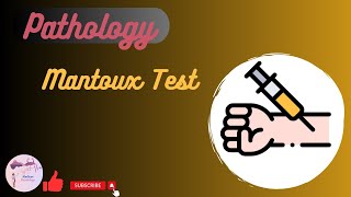 Mantoux Test [upl. by Edlin]