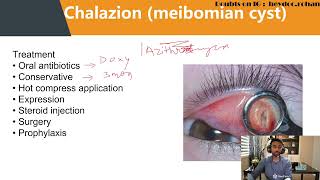 Eyelid Inflammatory Disorders Hindi NEET PG FMGE [upl. by Zaid95]