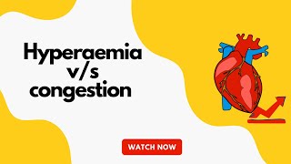 Hyperaemia vs congestion  pathology  MBBS [upl. by Ahseym]