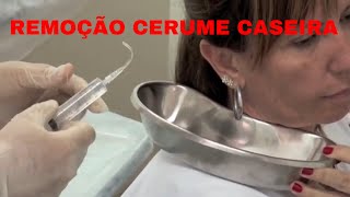 Lavagem ouvido caseira Vídeo Médico Lavar ouvido em casa Remoção cerume caseira [upl. by Kolk]