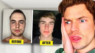 Average Guy 30 Day Looksmaxxing Transformation Detailed Analysis [upl. by Asilrak]