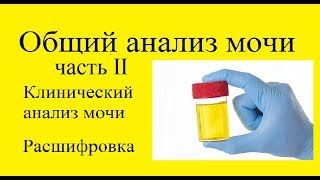 Общий анализ мочи часть 2 ОАМ клинический анализ мочи [upl. by Netnert]