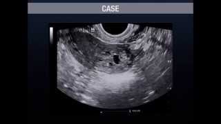 Ultrasound Podcast  Pregnancy Podcast Part 1 [upl. by Alard]