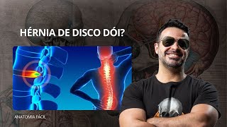 Hérnia de Disco dói  anatomiafacil [upl. by Oakley]