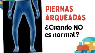 Piernas abiertas  ¿Es normal o no ¿Cuándo se sospecha enfermedad [upl. by Rozina410]