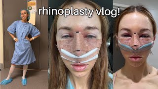 What its ACTUALLY like getting a RHINOPLASTY surgery  recovery vlog [upl. by Trish]