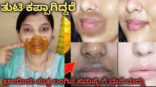 How To Remove Dark Black Patches Dark Spots Hyper Pigmentation Around Your MouthUneven Skin Tone [upl. by Nrehtak]