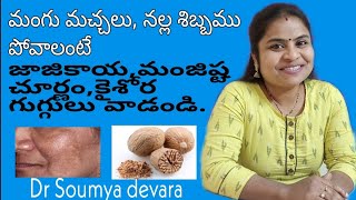 Mangu machalu povalanteNalla shibbamBonguMelasmaHyper pigmentation  Ayurvedam TeluguDr Soumya [upl. by Alyhs]