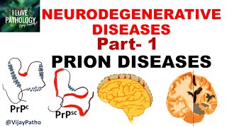 NEURODEGENERATIVE DISEASES PART 1 PRION DISEASES [upl. by Humbert]