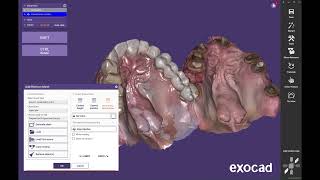 Aligning Multiple scans in Exocad [upl. by Armillda]