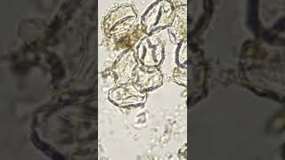 Eggs of Taenia solium Tapeworm under microscope [upl. by Auston]