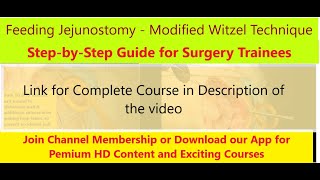 Feeding Jejunostomy Complete Guide FJ amp TG Series Part 33  See Video Description for Details [upl. by Orban825]