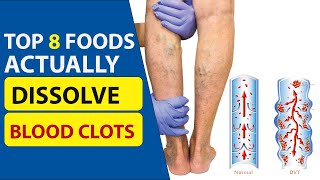 Top 8 Foods Actually Dissolve Blood Clots [upl. by Chavez645]