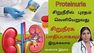 சிறுநீரில் புரதம் போவதால் காணப்படும் அறிகுறிகள் Proteinuria causes and symptoms [upl. by Rumpf]