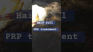 Hair full PRP treatment haircare shory fannyvideo explorepage hair [upl. by Asirac638]