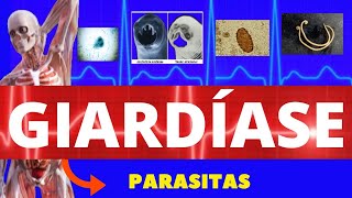 GIARDÍASE  GIARDIA LAMBLIA GIARDIA  PARASITOLOGIA INFECTOLOGIA  ENSINO SUPERIOR [upl. by Yerroc]