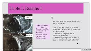 TRIPLE I INFLAMACION INFECCION INTRAUTERINA [upl. by Rora661]