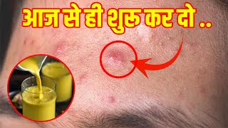 हल्दी वाला दूध पिने के ऐसे फायदे होंगे कभी सोचा नही था  Haldi Doodh Ke Fayde [upl. by Nolak]