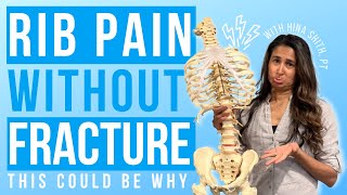 Rib Pain Without a Fracture Causes Symptoms and Treatment Options Explained [upl. by Nnaycnan]