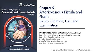 Hemodialysis Chapter 9 AVF amp AVG Basics Creation Use amp Examination  DrGawadEnglish Language [upl. by Soneson]