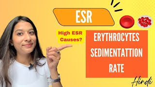 ESR  Erythrocytes Sedimentation Rate  Factors affecting ESR  Clinical Significance  Hindi [upl. by Irakab79]