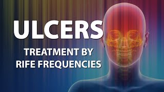 Ulcers General  RIFE Frequencies Treatment  Energy amp Quantum Medicine with Bioresonance [upl. by Miarhpe]