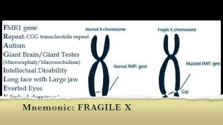 Fragile X Syndrome Mnemonic [upl. by Cher]