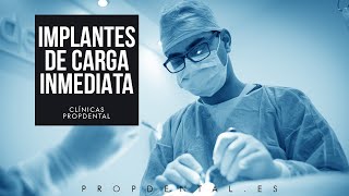 Cirugía de la colocación de implantes carga inmediata [upl. by Ahsoet578]