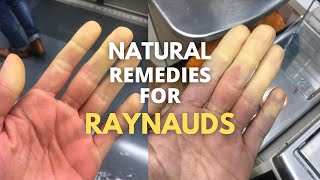 5 natural remedies for RAYNAUDS [upl. by Pooh]