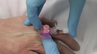 Cannulation How to insert a cannula One Minute Edition Medicine in a Nutshell IV Access [upl. by Suriaj232]