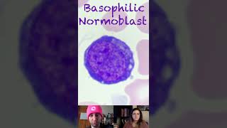 Basophilic Normoblast Morphological Characteristics [upl. by Lawtun]