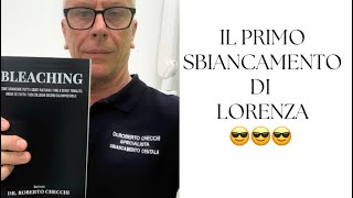 La storia di Lorenza e del suo sbiancamento dentale [upl. by Anha822]