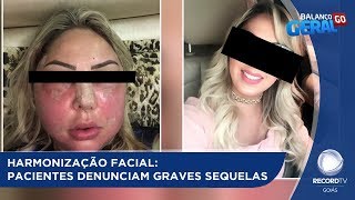 BALANÇO GERAL  HARMONIZAÇÃO FACIAL PACIENTES DENUNCIAM GRAVES SEQUELAS [upl. by Alrzc264]